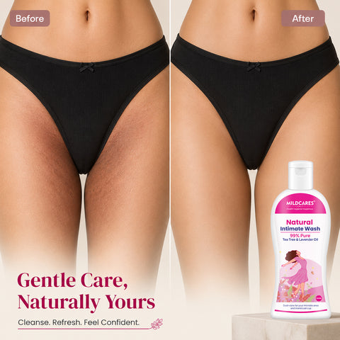 Female Intimate Wash (100 ML): Expert care for your intimate area